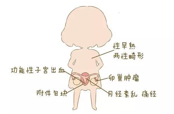 護理子宮，讓女性遠離婦科疾病