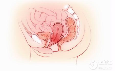 對(duì)子宮傷害很大的4個(gè)行為，女生別大意了！