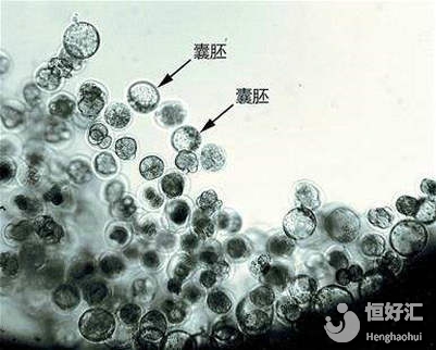 做試管嬰兒，每個人都適合養囊嗎？專家：別盲目跟風