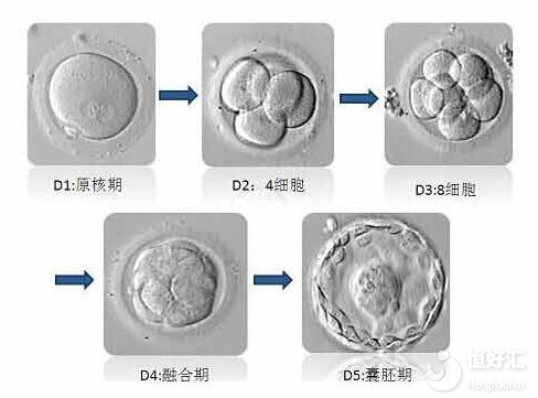 美國試管嬰兒對胚胎移植數(shù)量有要求嗎？