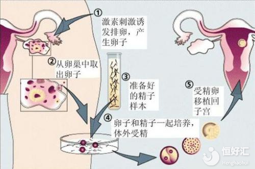 試管嬰兒很難承受的是這3點，別過于相信謠言