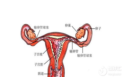 害怕輸卵管堵塞影響生育？這些方法可以有效防止