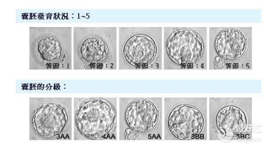 囊胚移植幾天著床？醫(yī)生：到了這一天請警惕！