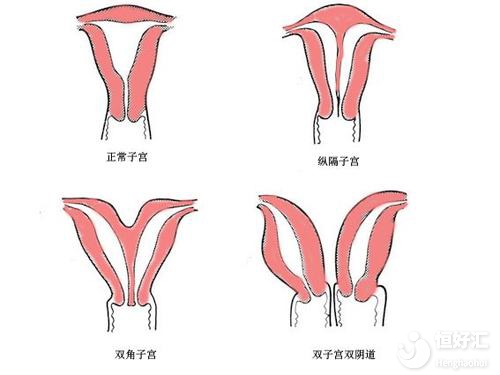 子宮偏小能懷上寶寶嗎？看完或許會嚇一跳