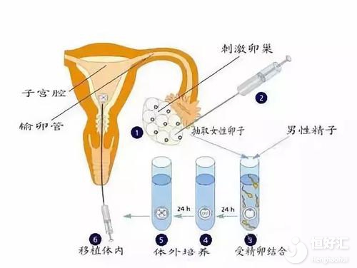 試管嬰兒取卵需要多長時間？或許沒你想的復雜