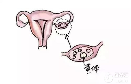 卵巢破裂應該如何調理？醫生：飲食調理或許有效