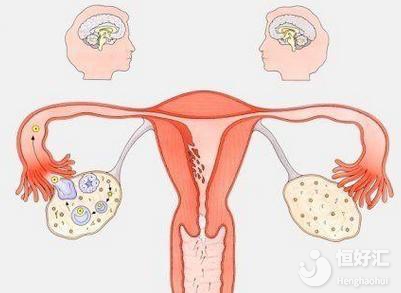 這就卵巢早衰了？中醫(yī)治療如何改善卵巢功能？