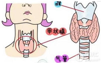 試管嬰兒為什么要查甲狀腺功能？醫生：圖的是這個