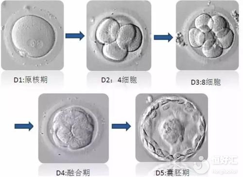 試管嬰兒胚胎等級越高，成功率就越高嗎？