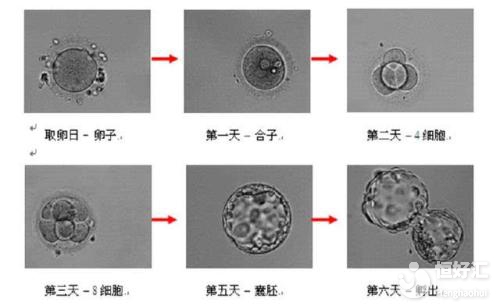 想養囊胚提高受孕率？首先要看自己合不合格