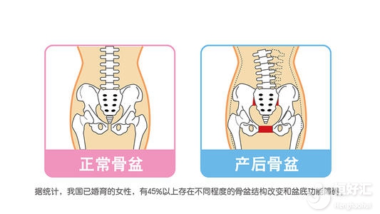 產后發生恥骨痛？掌握這些妙招助你趕走它