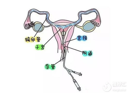 不孕檢查的最佳時間你知道嗎？快看這里