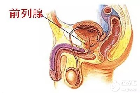 男方有前列腺炎會影響試管受孕嗎？