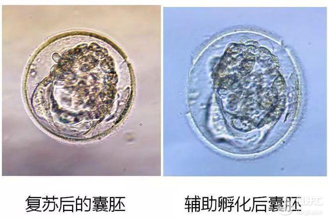 馬來西亞試管嬰兒醫院科普：為什么胚胎冷凍多年解凍后仍可使用？