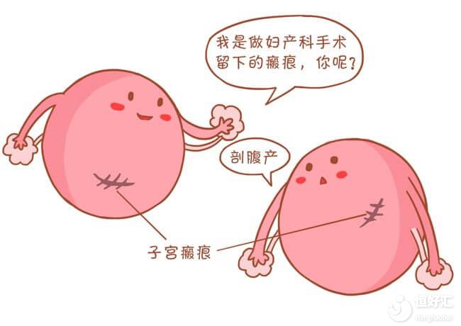 瘢痕子宮是什么？能做試管嬰兒?jiǎn)幔? /></a>
							<div   id=